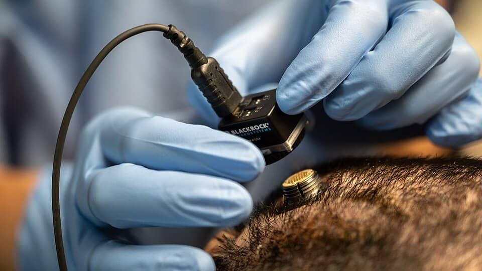 Photo: Brain–computer interface