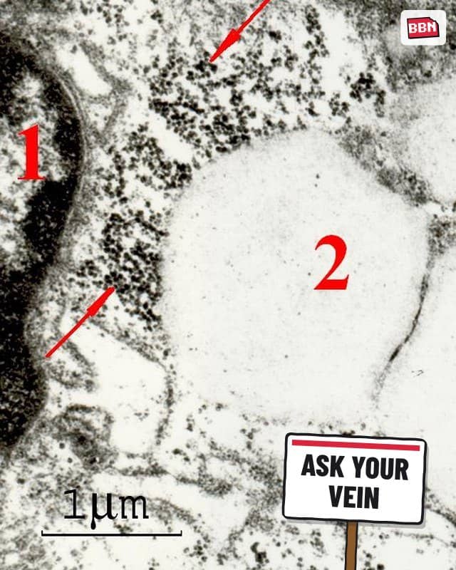 Photo: Ferritin
