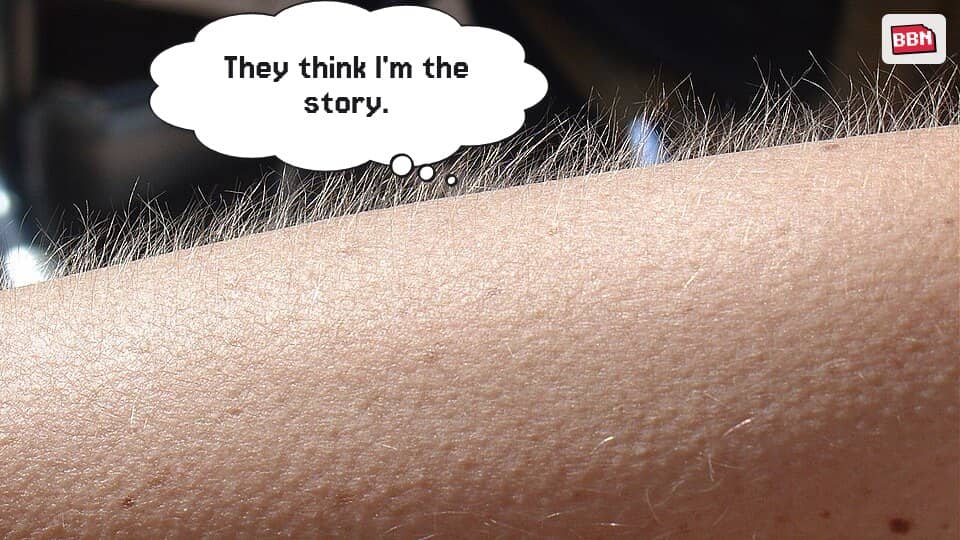Photo: Goose bumps
