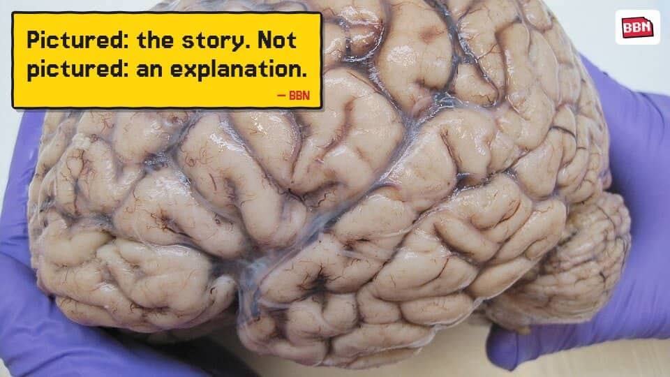 Photo: Human brain