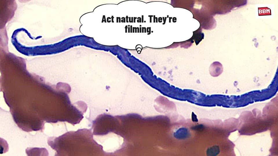 Photo: Loa loa filariasis