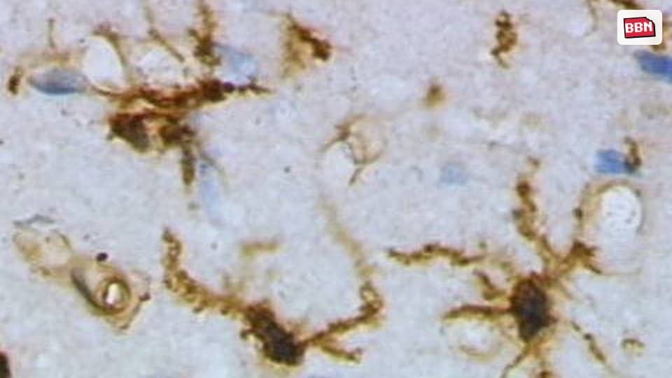 Photo: Microglia