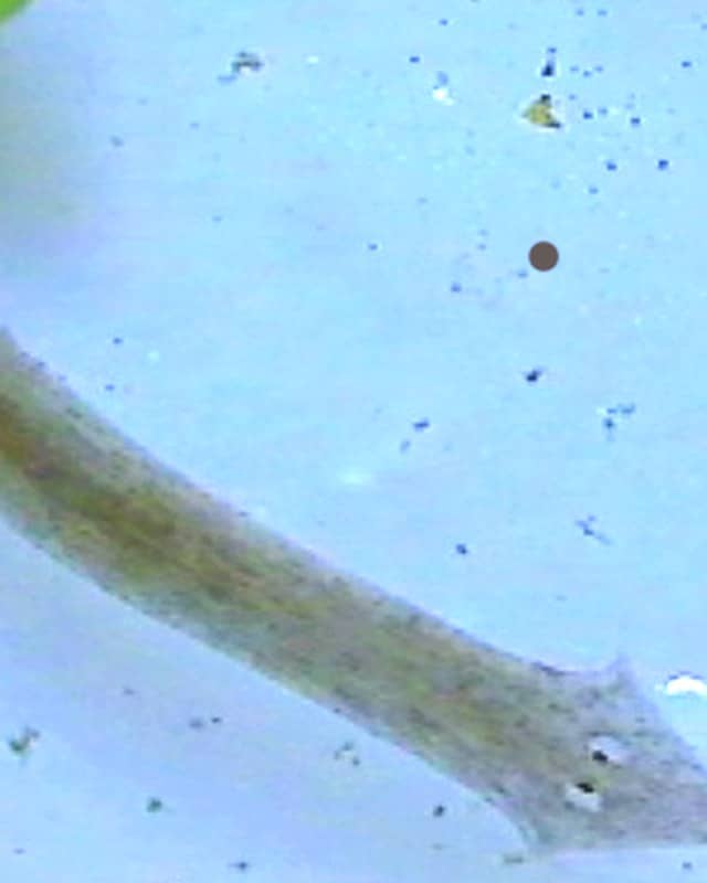 Photo: Planarian